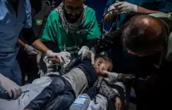 شهادات مروعة لأطباء بريطانيين عن إصابات غزة