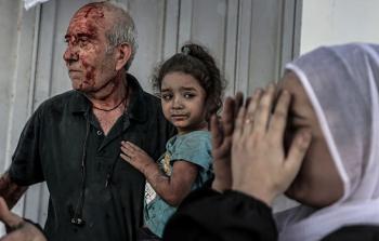 ارتقاء 79 شهيدًا خلال الـ 24 ساعة الماضية