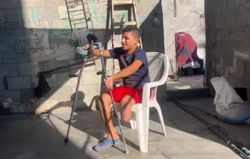بعد إعاقته بقصف إسرائيلي.. طرف صناعي يعيد الحياة لشاب غزي