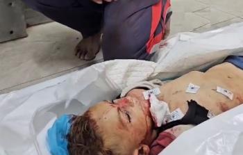 الطفل الشهيد سامي محمد عياد