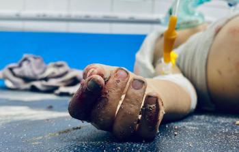 مسؤولون أمميُّون: الفلسطينيُّون في غزَّة يموتون وسط تأخيرات الإجلاء الطِّبِّيِّ