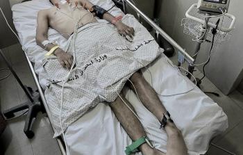 نداء للضغط على (إسرائيل) لضمان الإجلاء الطبي للصحفي الجريح من غزة فادي الوحيدي