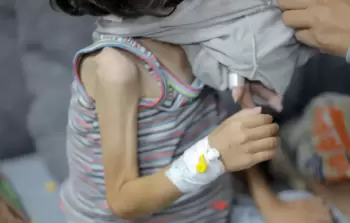 يونيسيف: 30% من الأطفال في قطاع غزَّة يعانون سوء التَّغذية الحاد