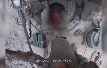 مشاهد توثِّق عمليَّة بتر قدَّم جنديّ (إسرائيلي) داخل 