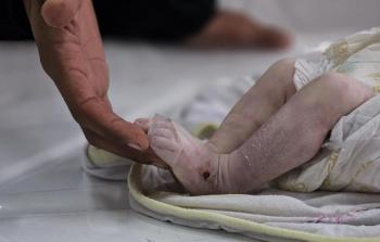 وفاة الرضيعة سيلا الفصيح بردًا في خيام النَّازحين بخانيونس