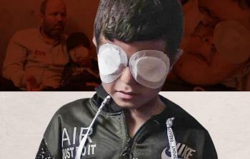 صورة تعبيرية