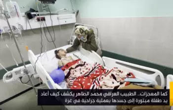 جرَّاح عراقيّ يروي تفاصيل إعادة يد مبتورة إلى جسد طفلة بغزَّة (فيديو)