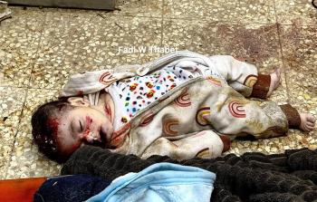 أبو سلميَّة: عاجزون عن استيعاب الأعداد المُتزايدة من المُصابين