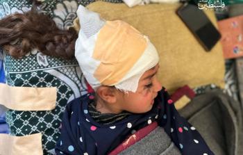 جنين... طفلة غزية أسكت القصف صوتها