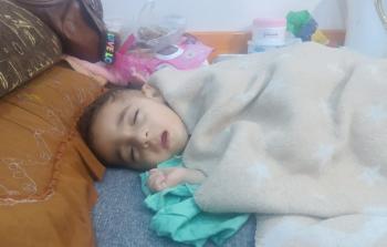 محمَّد وفؤاد... جسدان صغيران في قبضة المجاعة والمرض