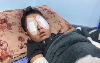 مخلفات الحرب.. سلاحٌ صامت يطفئ نور عيني الطفل حجازي