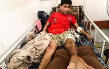 راني دغمش... جرح مفتوح لأقدِّم مصاب منوم بمستشفيات غزَّة
