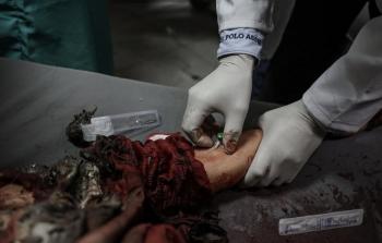 الاحتلال يُواصل حرب الإبادة الجماعيَّة على غزَّة لليوم الـ 21 تواليًا