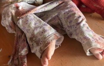 الأونروا: الاحتلال قتل ألف طفل منذ استئناف الإبادة على غزَّة