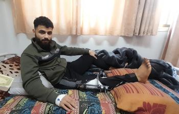 عمر الرَّاعي.. جريحٌ يصارع الوقت لإنْقاذ ساقه من البتر