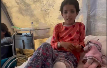 الحرب تحرم أسيل من ساقها وشقيقها.. ولكن لا تستطيع قتل حلمها