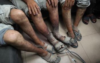 نادي الأسير: منظومة سجون الاحتلال تستخدم عمليات نقل الأسرى لنشر الأوبئة