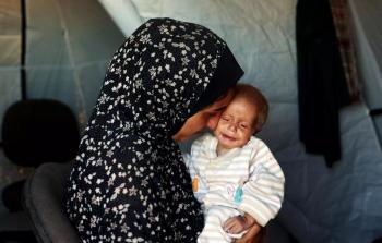 سوء تغذية نساء غزة أطفال