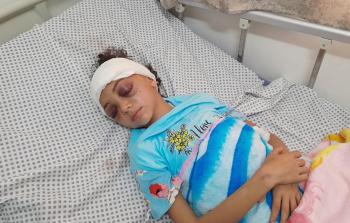 فاتنةً الغصين... طفلة سحقت حياتها غارةً إسرائيليَّةً