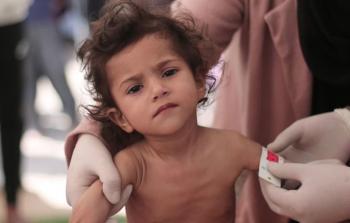 مجلس كنائس الشرق الأوسط يفتح باب التسجيل لبرنامج دعم سوء التغذية في غزة