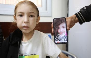 رهف عيَّاد... جسد نحيل يختصر وجع أطفال غزَّة