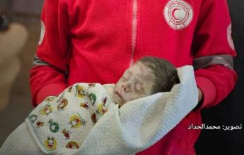 الصِّحّة بغزَّة: 82 شهيدًا و 152 إصابة خلال الـ 24 ساعة الماضية