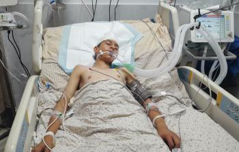 أحمد الغرابلي.. عيونٌ لا تفتح وطفولة علّقتها شظايا الحرب