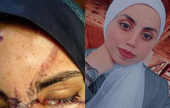 عيَّن حنين... شهادة حيَّة على وجع غزَّة الَّذي لا يمحى