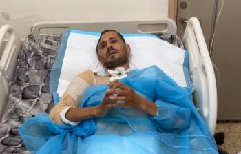 أحمد مطر.. العدسة التي رفضت السّقوط في وجه الموت