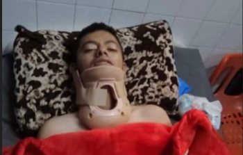 محمد.. شابٌ يافع شلَّت الحرب أحلامه وجسده