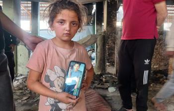 حين سقط الصاروخ على الحلم .. 30 طفلًا ونازحًا احترقوا وهم نائمون  