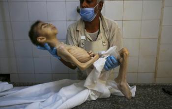 الأمم المتَّحدة: 14 ألف طفل قد يموتون في غزَّة إذا لم تصلهم المساعدات