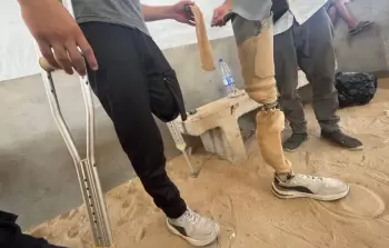 بترت الحرب ساقه.. الشاب 