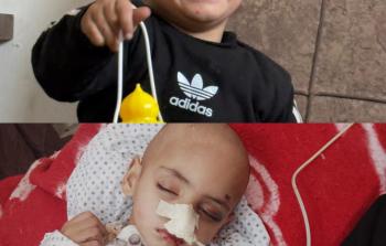 الطفل الهمص يصارع الألم بصمت بانتظار السفر للعلاج بالخارج