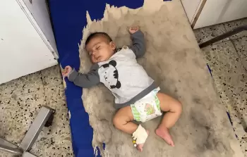 كارثةٌ صحيَّة جديدة.. 35 حالة حمى شوكية في مجمع ناصر الطِّبي