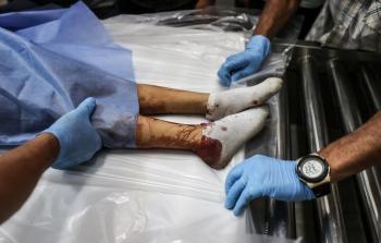 مجازر لا تتوقَّف واستهداف مباشر للمُجوَّعين.. الاحتلال يواصل حرب الإبادة الجماعيَّة على قطاع غزَّة