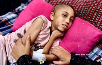 جراحها خطيرة لا تندمل.. 