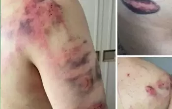 جنود الاحتلال يعتدون على شاب أثناء مروره على حاجز قرب أريحا