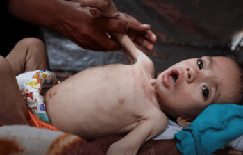 حماس: أطفال غزة يواجهون كارثة صحية ونطالب بتدخل دولي عاجل