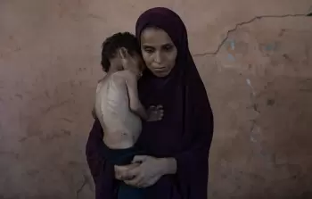 اسكوتلندا تحث رئيس الوزراء البريطاني على التعاون لإنقاذ أطفال غزة