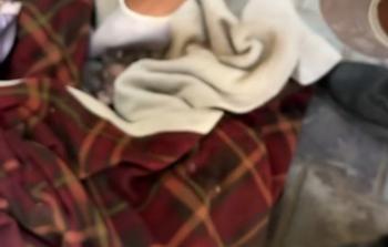 مجزرة بلا ذنب.. الاحتلال يغتال جنينًا ويقطع رأسه في أحشاء أمه