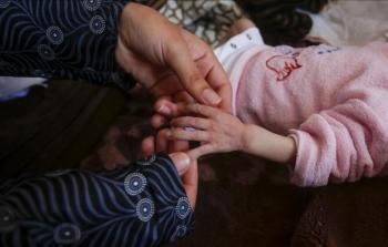 وفاة طفل رضيع في غزَّة نتيجة سوء التغذية ونقص الحليب