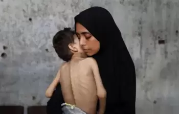 الدقران: الأطفال يصلون إلى مستشفيات غزَّة على هيئات هياكل عظميَّة