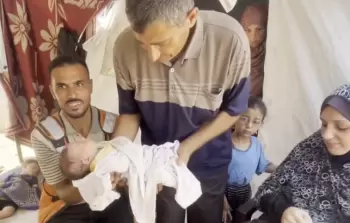 تحت القصف.. مسعف يُجري عملية ولادة بأدوات بدائية وينقذ أمًا وطفلتها بغزة