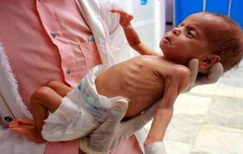 حماس: غزَّة تواجه أخطر مراحل الإبادة... 40 ألف رضيع مهدَّدون بالموت