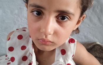 جوري بين الورم والانتظار.. ملفها الطبي تحت الركام