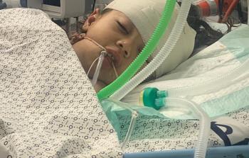 الطفلة ميرا تعاني أوضاعا نفسية سيئة في صراعها مع الشلل وفقدان النطق