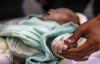 7 حالات وفاة خلال الـ24 ساعة الماضية جرَّاء المجاعة وسوء التَّغذية