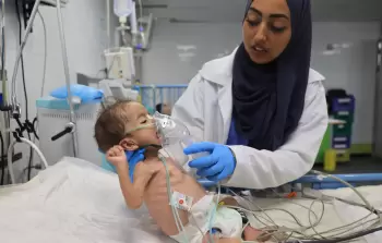 الصِّحَّة: مجاعة كارثية في غزَّة وارتفاعٌ ملحوظ في معدل الوفيات بسبب سوء التَّغذية