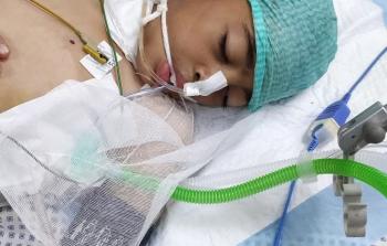 طفل على جهاز التَّنفُّس... إيهاب يقاوم شظايا الموت في غزَّة